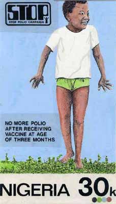 Nigeria 1984 Stop Polio Campaign - original hand-painted artwork for 30k value (Healthy Child) by NSP&MCo Staff Artist Olukoya Ogunfowora on card 5 x 8.5 endorsed C2, stamps on , stamps on  stamps on disabled, stamps on  stamps on diseases, stamps on  stamps on medical, stamps on  stamps on 